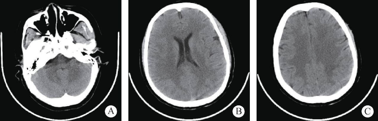 夏季饮水，准妈妈们不要“一次喝个够”