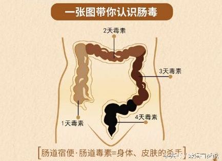孕期便秘难言之苦怎么办,孕期便秘就是拉不出来怎么办