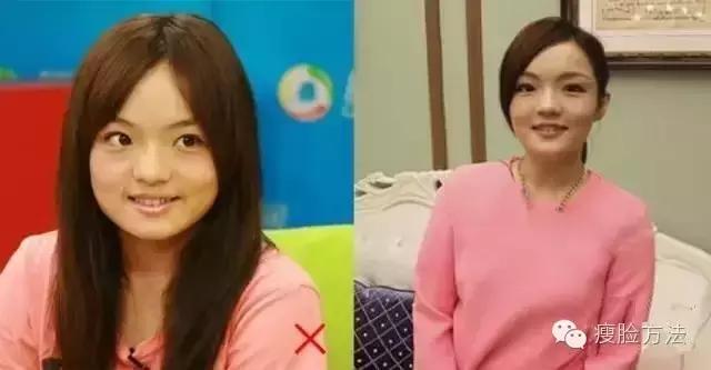 大长脸能留短发吗,大脸女孩真的适合短发吗