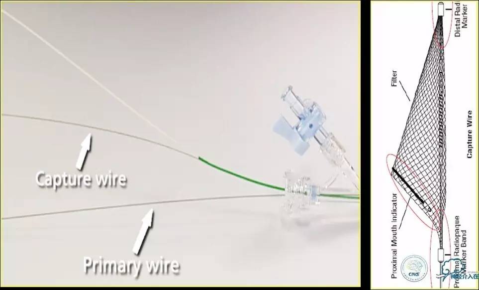 颈动脉次全闭塞,颈动脉次全闭塞中医疗法