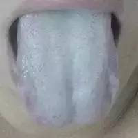 身体最健康舌头是怎么样的,健康人是什么体质