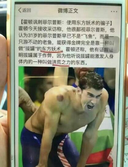 中国魔法拔火罐,北京奥运村拔火罐