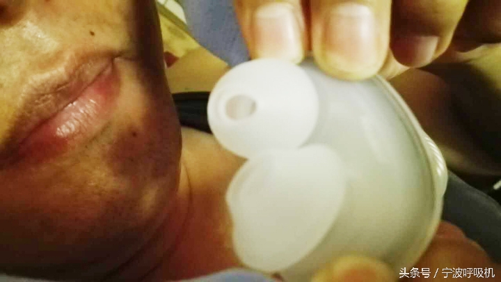 瑞思迈呼吸机面罩,瑞思迈airsense10呼吸机鼻罩