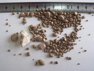 经常憋尿会引起肾脏疾病吗,刘旭生iga肾病4级有多严重