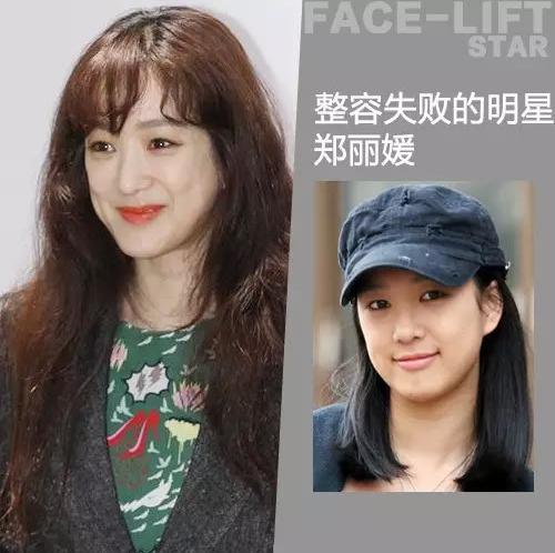 整形越早越好还是越晚越好,整形反而把自己越整越丑怎么办