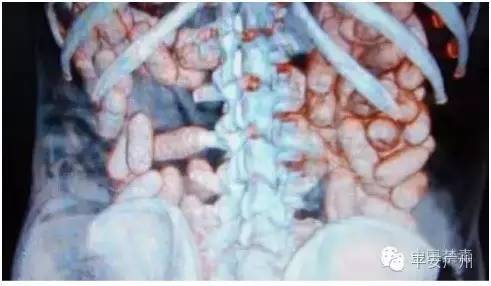 人体藏毒科普,人体藏毒有多厉害