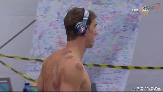 拔罐疗法的总结,拔罐疗法的适应症及注意事项