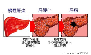 大三阳转小三阳对人身体什么好处,乙肝大三阳对另一半影响大吗