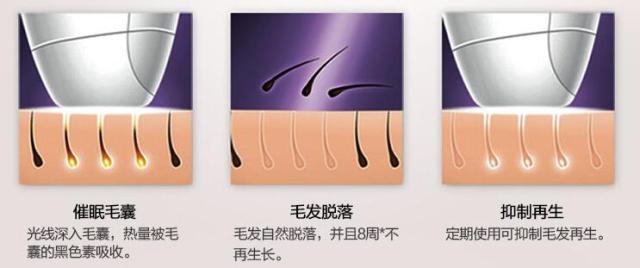 如何选择家用脱毛仪,适合嫩肤的脱毛仪