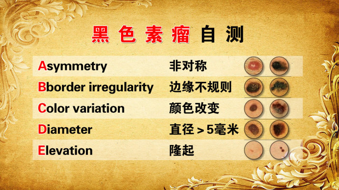 孙红雷谈黑痣长在哪里,孙红雷演的黑痣病变