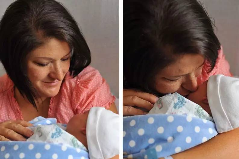 小孩患唐氏综合征,唐氏综合征比较幸运的孩子