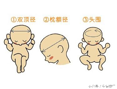 孕期大排查一般怎么做,胎儿双顶径直径