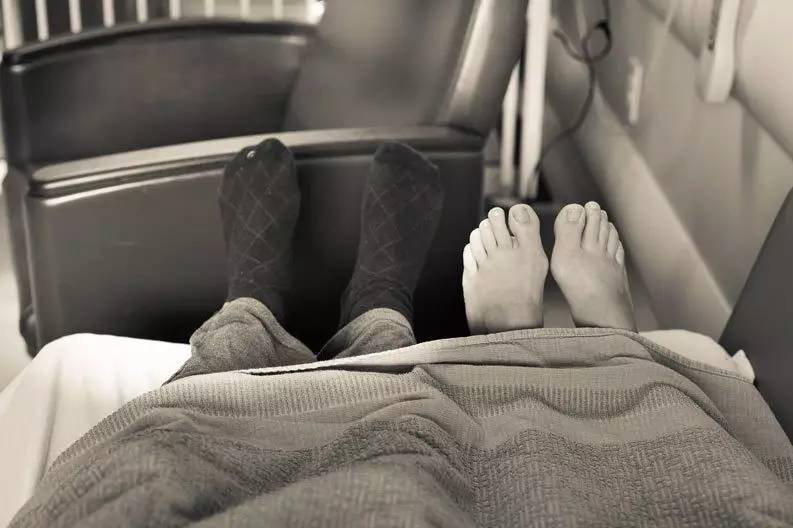 小孩患唐氏综合征,唐氏综合征比较幸运的孩子