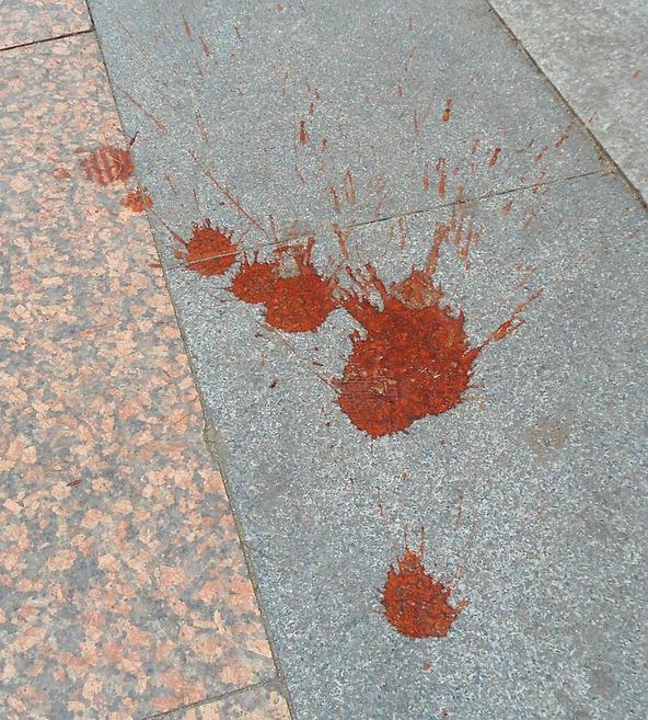 吃槟榔胸闷气短呼吸困难心慌,槟榔为什么吃了会胸闷有害处