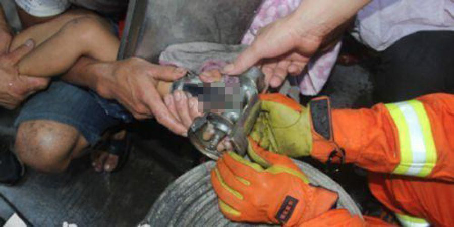 2岁男童拇指被绞断家长切勿大意,新疆8岁男孩干活手臂被绞断