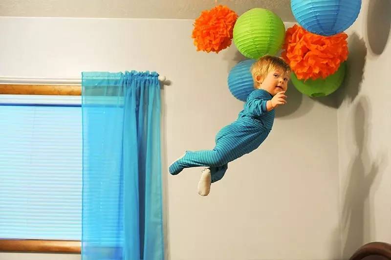 小孩患唐氏综合征,唐氏综合征比较幸运的孩子