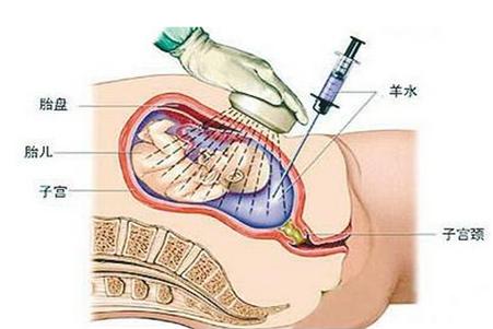 高龄产妇生二胎怎么办,高龄产妇生二胎危险视频