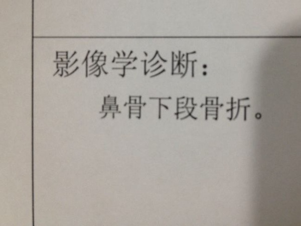 踢球被撞骨折,踢球导致鼻子骨折如何赔偿