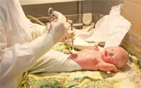 院长剖腹产,剖腹产后医生必做的几件事