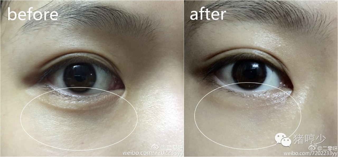 眼周护理珍萃眼膜,眼周保养护肤品