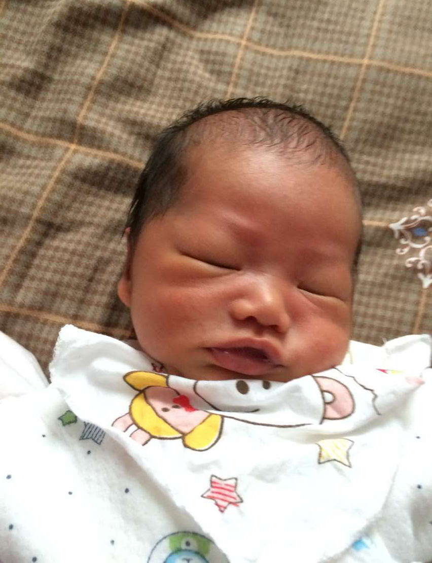 我就是妇产科主任说的30年难得一见的病人