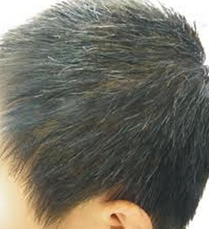 少年有白发吃什么好,年轻人白发如何养生