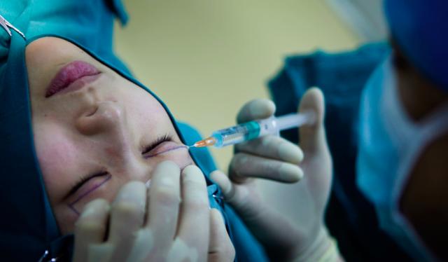 为什么大家都喜欢大眼睛双眼皮,为什么大家喜欢做双眼皮手术