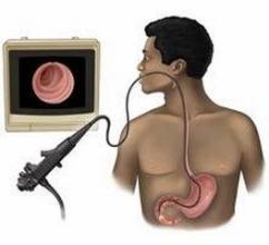 胃肠镜检查出息肉怎么办,胃肠镜息肉是怎么来的