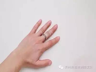 戒指无名指被卡住了怎么办,戒指卡住了不拔会发生什么
