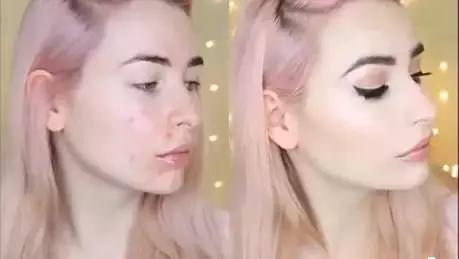 有闭口痘痘化的妆,脸上有粉刺痘痘怎么化底妆