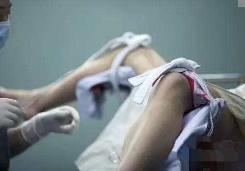 打过胎的女人外表有什么特征,女生有没有打过孩子怎么看