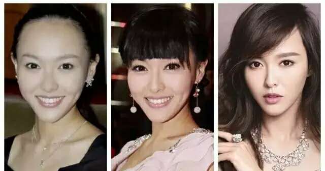 额头宽发际线高真的不好看吗,额头太秃了发际线高