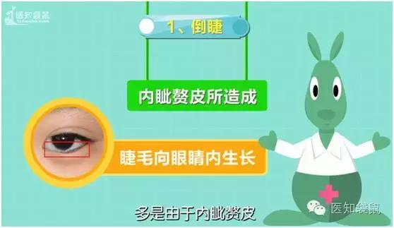 儿童医院专家告诉你：宝宝流眼泪、长眼屎的真相