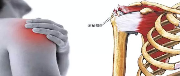 大夫不建议做造影,做ct检查是否就不用做超声检查