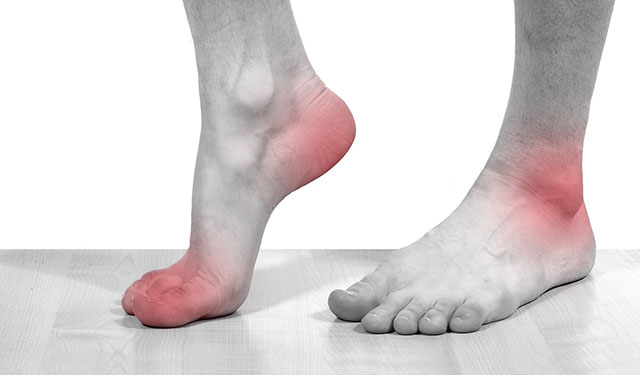 痛风的人尽量少吃什么,痛风的人别再吃生蚝了