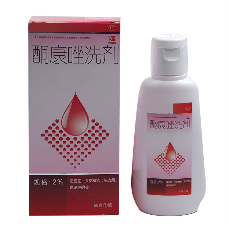 头皮屑多到底怎么回事,女人头皮屑多怎么回事