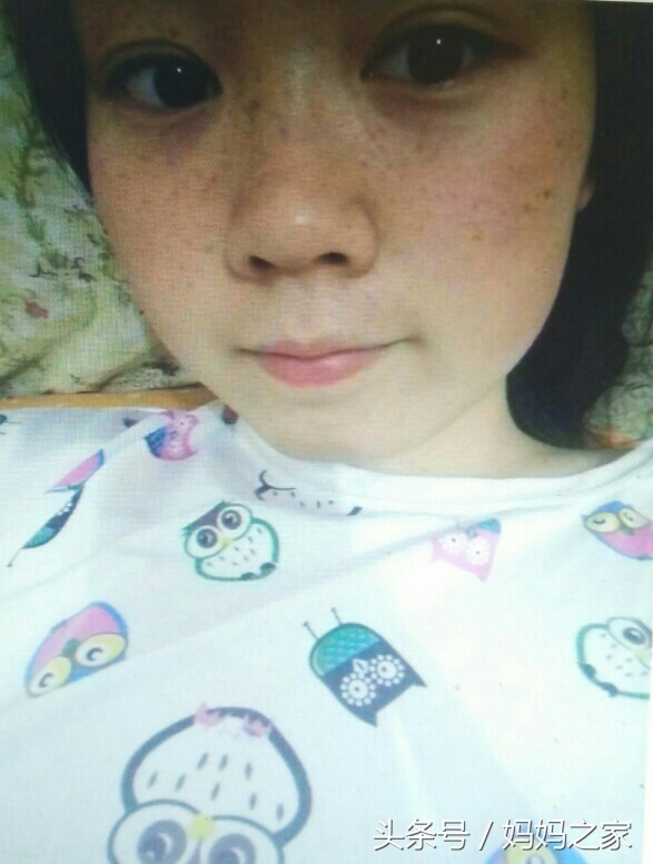 为什么女人自从怀孕后这几个地方都会变黑呢?怎么做才能恢复?