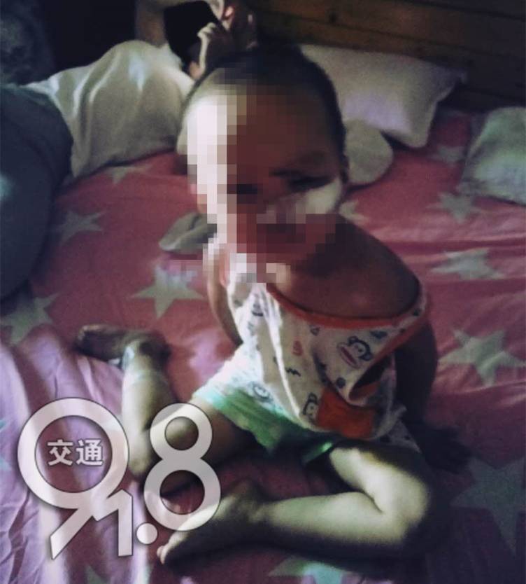 1岁孩子眼睛角皮刮破了,2岁宝宝眼睛旁边划破了会留疤吗