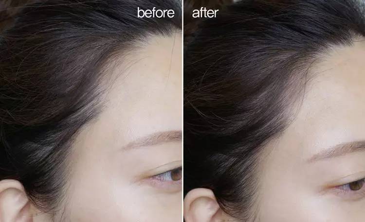 发际线决定人的智商,发际线决定气质