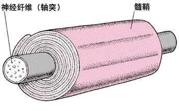 椎管内良性肿瘤最佳治疗方法,神经鞘瘤在椎管内还是椎管外