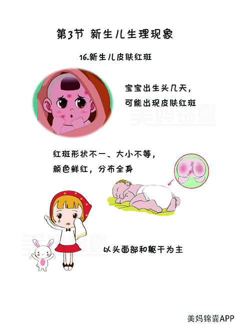 宝宝湿疹比较严重会影响喝奶吗,奶粉引起的湿疹特征