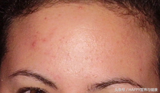 皮肤科怎么治疗长疮,皮肤疮的症状有哪些