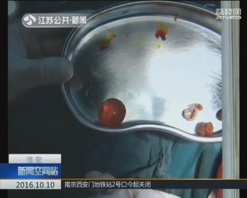 小孩误食玩具多危险,男童误食滴水观音险丧命