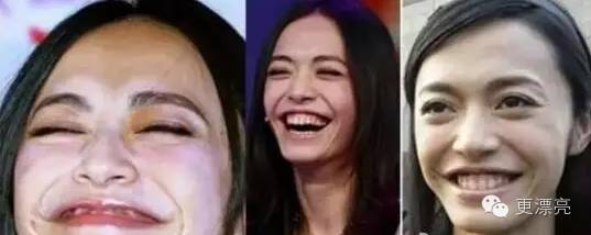 爱笑的女孩法令纹都很深,爱笑的女孩法令纹都不会太差