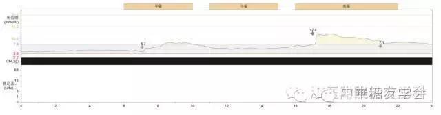 最好最精确的血糖监测仪,监控血糖软件