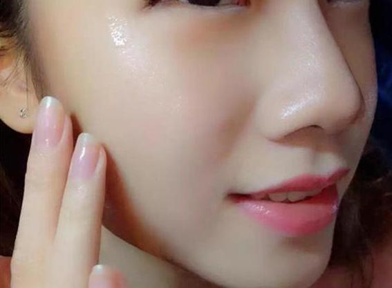 美白祛斑祛痘抗皱五件套,祛斑祛痘美白抗皱