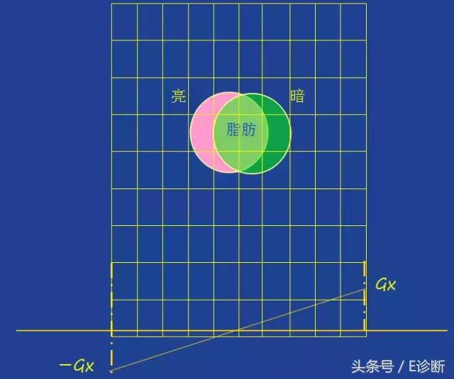 磁共振伪影及解决方案,e系列诊断