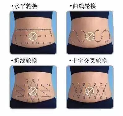 糖友讨论：偏瘦、戴泵的糖宝埋置针头部位