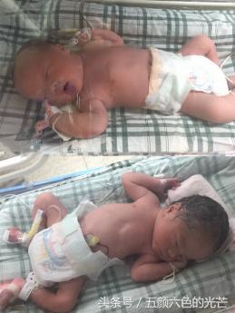 泰国做试管要经历什么,在泰国做试管婴儿的真实经历