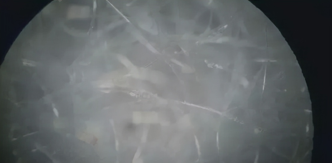 如何去除被窝里的螨虫,什么妙招祛除螨虫